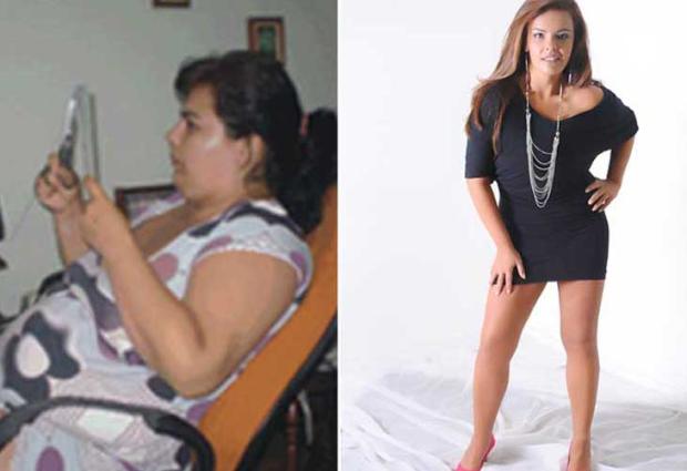 "Desisti da bariátrica no dia da cirurgia e emagreci 55 quilos", conta jovem que superou a obesidade Arquivo Pessoal/