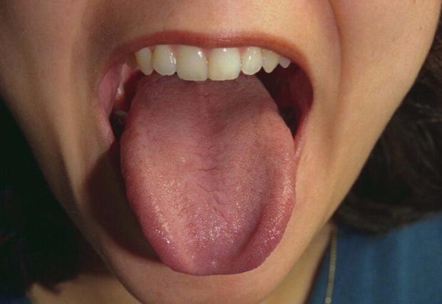Confira cinco dicas para evitar mau hálito Ver Descrição/Ver Descrição
