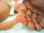 Há como prevenir o nascimento antecipado do bebê? Júlio Cordeiro/Agencia RBS Há como prevenir o nascimento antecipado do bebê? Júlio Cordeiro/Agencia RBS