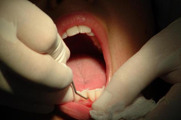 Limpeza profissional dos dentes ajuda a reduzir risco de infarto e AVC Marcos Porto/BD JSC Limpeza profissional dos dentes ajuda a reduzir risco de infarto e AVC Marcos Porto/BD JSC