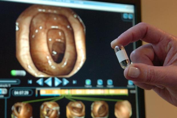 Não tenha medo da endoscopia Genaro Joner/Agencia RBS Não tenha medo da endoscopia Genaro Joner/Agencia RBS