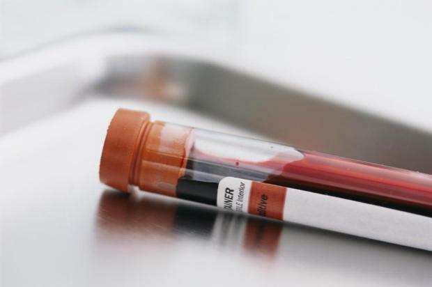 Medição de taxa de creatinina no sangue pode prevenir males no fígado e no coração Peter Frenty/Stock.Xchng Medição de taxa de creatinina no sangue pode prevenir males no fígado e no coração Peter Frenty/Stock.Xchng