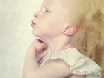 Confira imagens de "Albinos", o ensaio vencedor do 10º Prêmio FCW de Arte - Fotografia