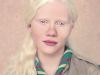 Gustavo Rodrigues de Lacerda ganhou o 10 º Prêmio Fundação Conrado Wessel de Arte (Fotografia) com o ensaio "Albinos"    