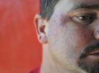 Irmãos acusam policiais de agressão em Alvorada Mateus Bruxel/Agencia RBS Irmãos acusam policiais de agressão em Alvorada Mateus Bruxel/Agencia RBS