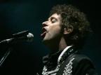 Gustavo Cerati segue em coma dois anos após sofrer isquemia cerebral Leonardo Ramirez/AP Gustavo Cerati segue em coma dois anos após sofrer isquemia cerebral Leonardo Ramirez/AP