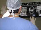 Neuronavegador: Inovação na cirurgia de remoção de tumores no cérebro Divulgação/Divulgação Neuronavegador: Inovação na cirurgia de remoção de tumores no cérebro Divulgação/Divulgação