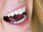 Ministério da Saúde libera R$ 7,4 milhões para próteses dentárias Júlio Woolpert/Stock Photos/Divulgação Ministério da Saúde libera R$ 7,4 milhões para próteses dentárias Júlio Woolpert/Stock Photos/Divulgação