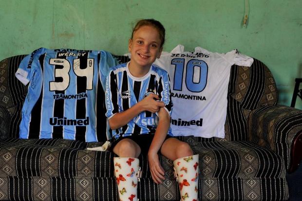Menina Karine fará cirurgia neste sábado em Caxias do Sul Lívia Stumpf/Agencia RBS Menina Karine fará cirurgia neste sábado em Caxias do Sul Lívia Stumpf/Agencia RBS