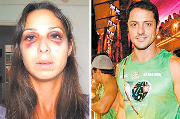 Ex de Luana Piovani é acusado de agredir a namorada, diz site Reprodução/ O Dia/