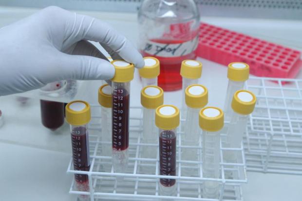 A importância dos exames pré-operatórios para o sucesso da cirurgia Adriana Franciosi/Agencia RBS
