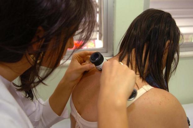 Cientistas descobrem novas mutações do melanoma Daniel Conzi/Agencia RBS Cientistas descobrem novas mutações do melanoma Daniel Conzi/Agencia RBS