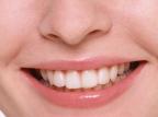 Sete sinais de que você precisa consultar um dentista Divulgação/Divulgação Sete sinais de que você precisa consultar um dentista Divulgação/Divulgação