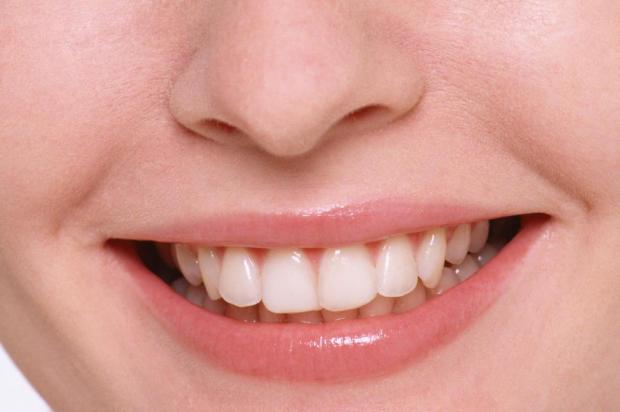 Sete sinais de que você precisa consultar um dentista Divulgação/Divulgação Sete sinais de que você precisa consultar um dentista Divulgação/Divulgação