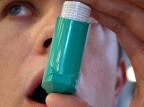Medicamento promissor contra a asma é apresentado nos Estados Unidos Divulgação/Blog Asma - Tratamento Medicamento promissor contra a asma é apresentado nos Estados Unidos Divulgação/Blog Asma - Tratamento