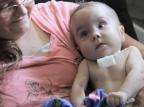 Peça feita em impressora 3D salva vida de bebê Reprodução/YouTube Peça feita em impressora 3D salva vida de bebê Reprodução/YouTube