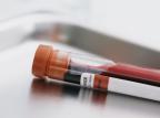 SUS amplia controle sobre qualidade de sangue doado Peter Frenty/Stock.Xchng