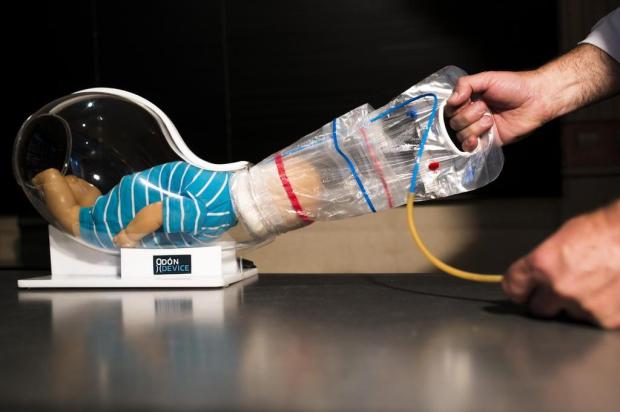 Mécânico inova e cria método que utiliza sacola plástica para auxiliar em partos difícieis Diego Giudice/NYTNS