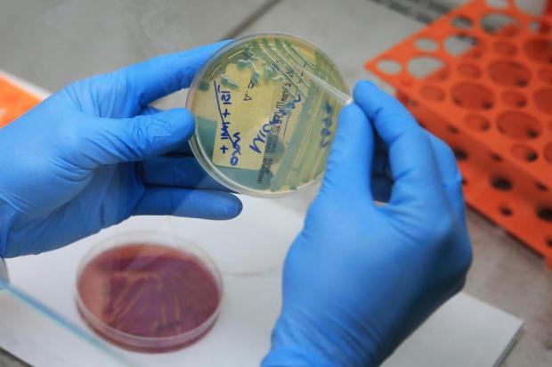 Mutações genéticas podem impedir combate de infecções por micobactérias Diego Vara/Ageência RBS Mutações genéticas podem impedir combate de infecções por micobactérias Diego Vara/Ageência RBS